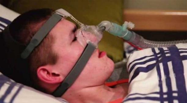 Liam Derbyshire se conecta a un respirador cada vez que se acuesta para dormir. Foto: Tomada de Infobae